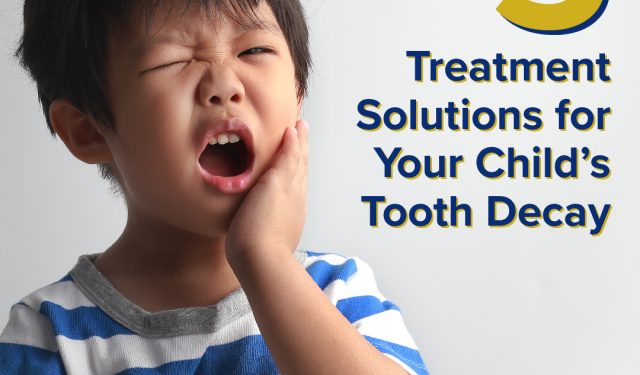 Five Treatment Solutions For Your Child’s Tooth Decay (featured image)