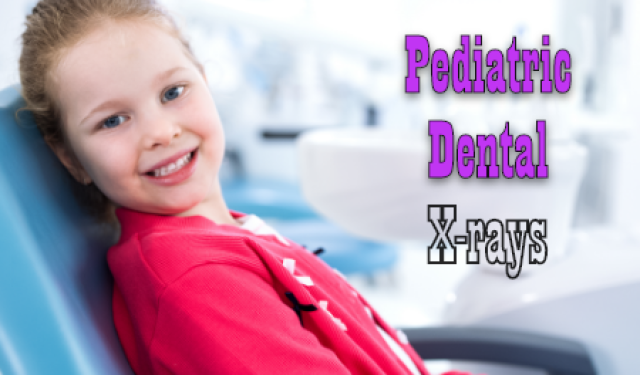 Pediatric Dental X-rays: What You Need To Know (featured image)